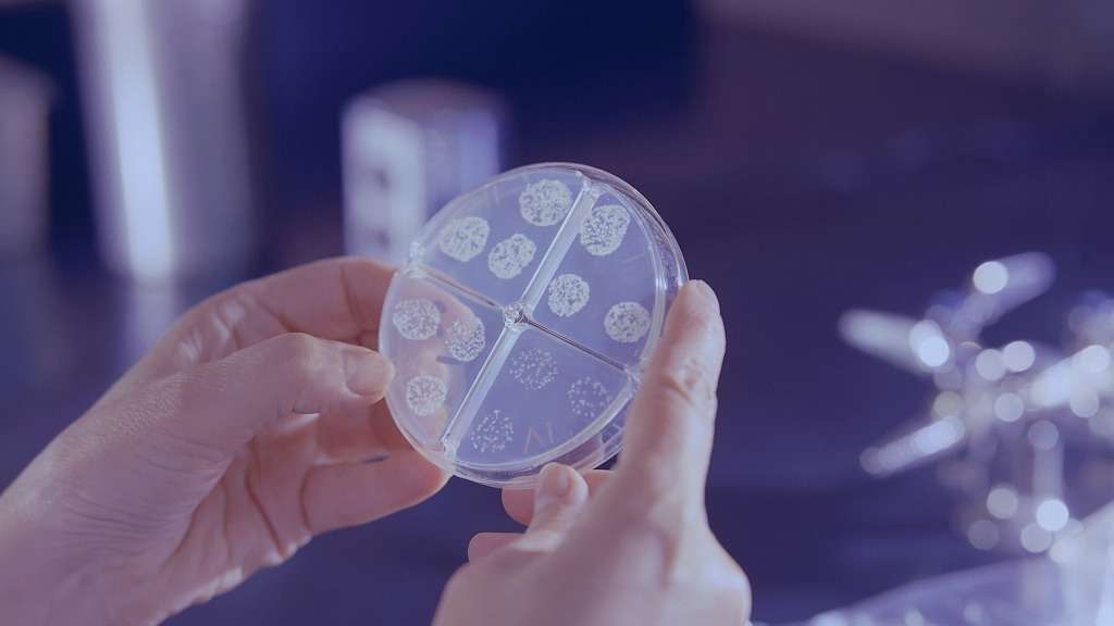 Bacteria being held on a small transparent screen